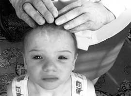 ДЕТСКИЕ ШРАМЫ: следы изуверских побоев